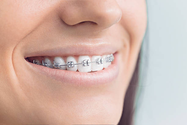 Best Tooth Extraction  in Frederickson, WA
